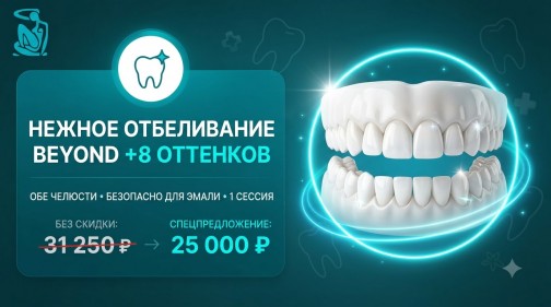 Акция на отбеливание Beyond за 25000