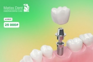 Акция на имплантацию!