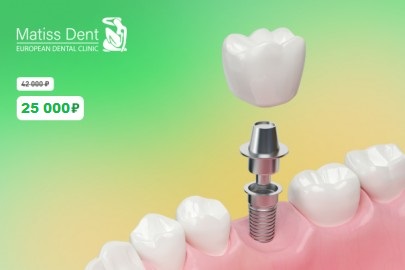 Акция на имплантацию!