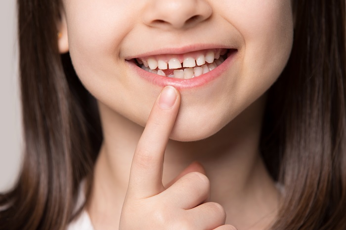 Что делать если болит зуб? 46 проверенных способов избавления от зубной боли